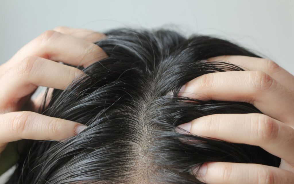 Tóc bết vì cơ địa
