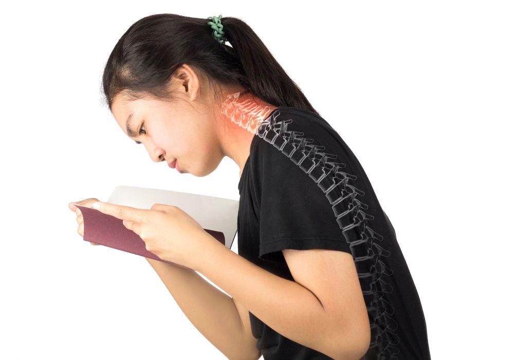 Hội chứng cổ rùa là gì