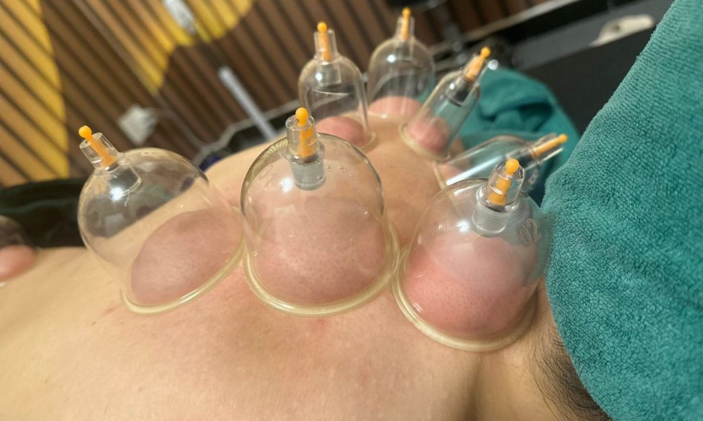 Thực hiện giác hơi và trượt giác