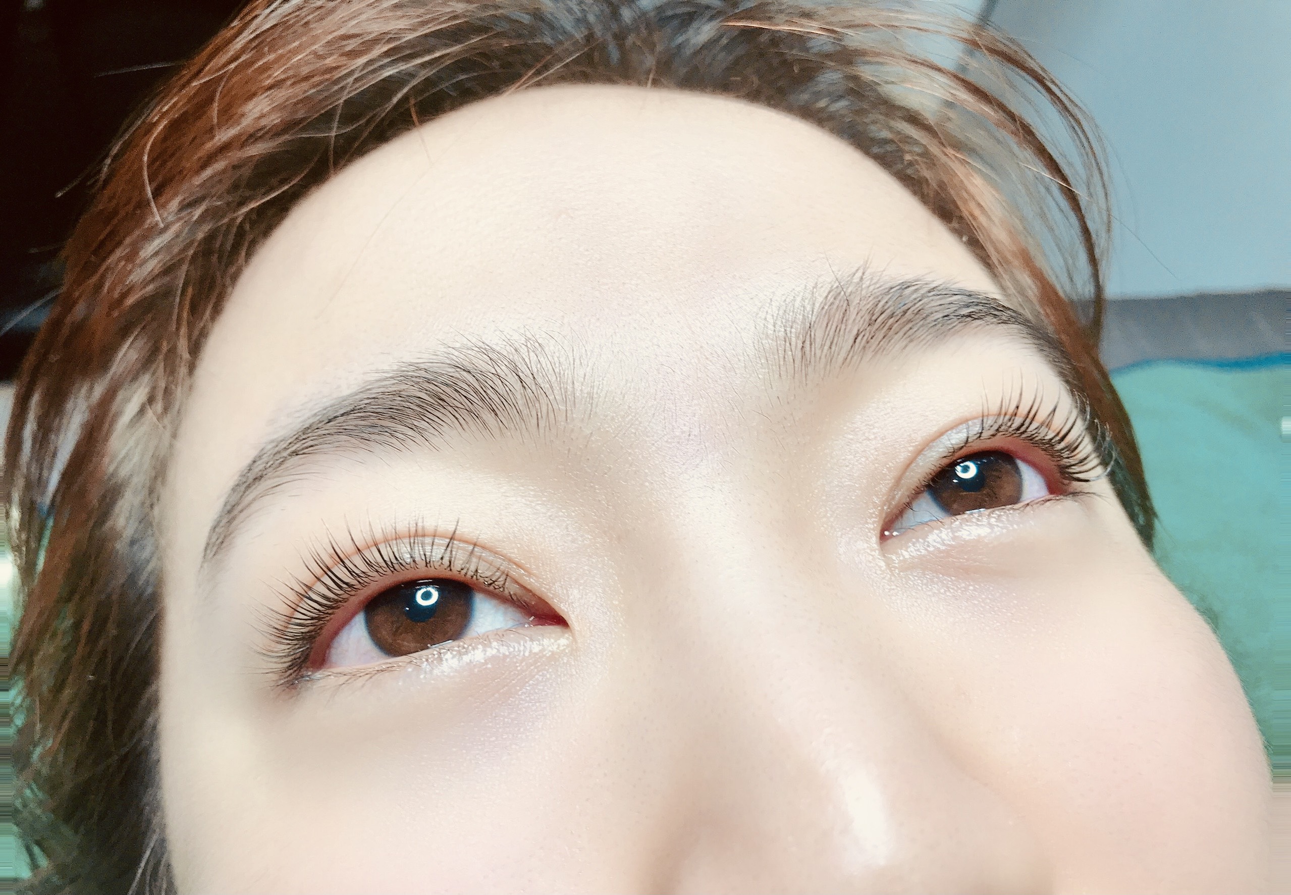 mi collagen sau khi uon