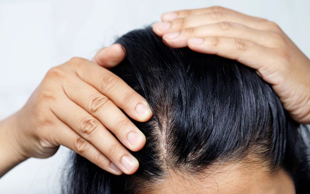 Thúc đẩy sự phát triển của tóc