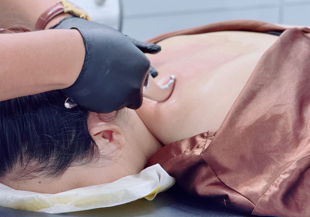 Trải mạc cơ là gì?