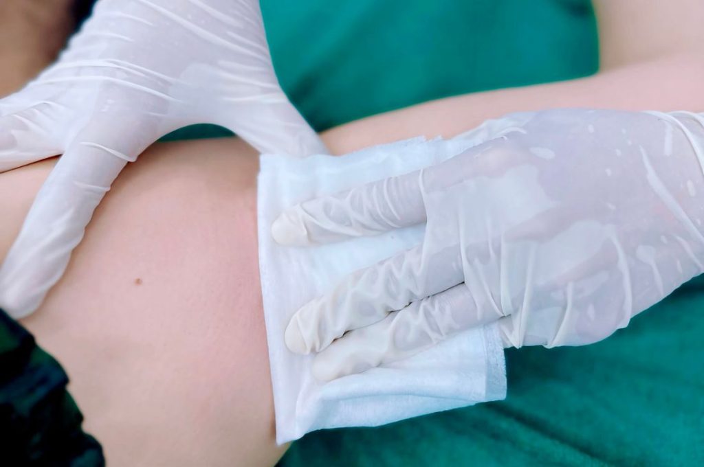 Cần lưu ý gì trước và sau khi triệt lông?