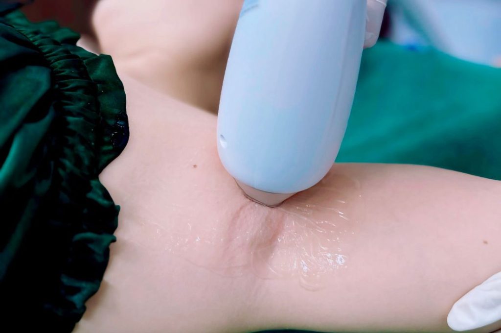 Quyền lợi của khách hàng khi triệt lông nách tại Hi Spa