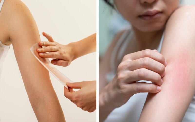 Người đang tẩy lông tay bằng sáp và người khác đang chạm vào vùng da bị đỏ trên cánh tay.